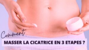 Césarienne : comment masser la cicatrice en 3 étapes ?