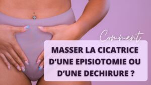 Comment masser la cicatrice d'une épisiotomie ou d'une déchirure ?